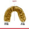 Dantų-apsauga-OPRO-Gold