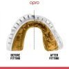 Dantų-apsauga-turintiems-breketus-Opro-Self-Fit-Gold-Braces Dantų-apsauga-turintiems-breketus-Opro-Self-Fit-Gold-Braces