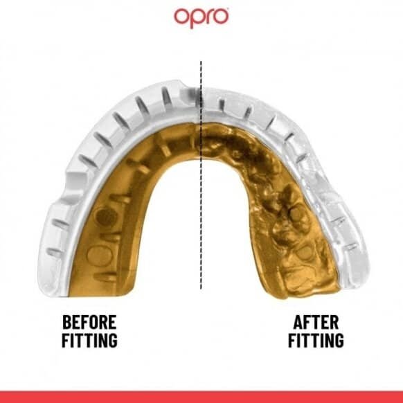 Dantų-apsauga-turintiems-breketus-Opro-Self-Fit-Gold-Braces Dantų-apsauga-turintiems-breketus-Opro-Self-Fit-Gold-Braces