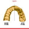 Dantų-apsauga-Opro-Instant-Custom-Fit
