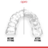Dantų-apsauga-Opro-Instant-Custom-Fit
